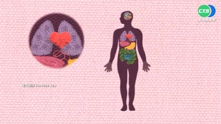 癌細胞愛"糖" 醫:澱粉糖類攝取降至1/3