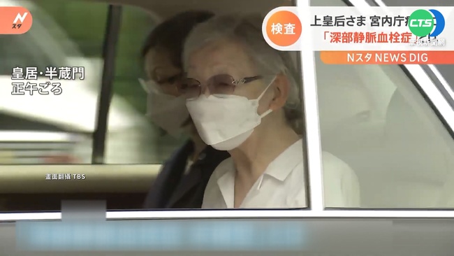 日本上皇后美智子靜脈血栓 送宮內廳醫院檢查 | 華視新聞