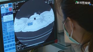 「4分20秒有1人罹癌」 國健署：線上資源陪伴抗癌不孤單