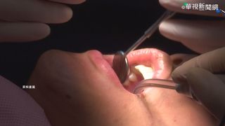 台灣成人牙周病盛行高率8成 醫揭：中風機率多2.1倍