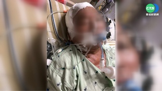 新北警將老翁撞成植物人 家屬控"造假證據"