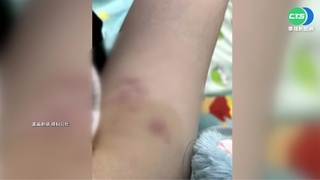 百貨公司爆隨機打人 女子逛美食街"遇襲"