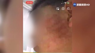 10歲童遭父痛毆 母"無監護權"帶兒離校遭拒