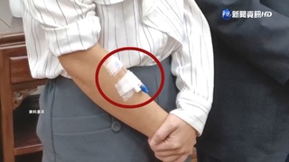 高虹安未拆靜脈留置針離院 醫:不良示範