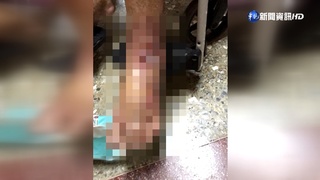 疑長照沒注意洗澡水溫 91歲嬤燙傷2天猝逝!