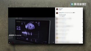 楊祐寧再當爹啦! 秀超音波報喜"迎2胎"