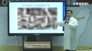 新型療法助治傷　粉碎性骨折6周癒合.恢復行走