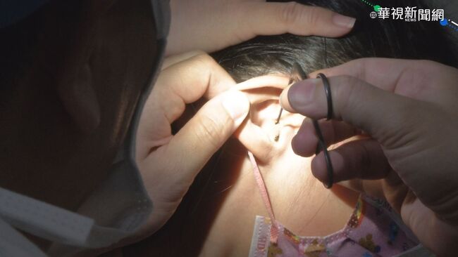 耳朵莫名嗡嗡叫　竟差點變成「突發性耳聾」　醫：有症狀應及時就醫 | 華視新聞