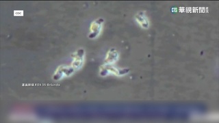 佛州男用自來水沖洗鼻腔　疑染「食腦蟲」喪命