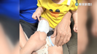 1歲童抓餐盤遭湯灑燙傷　母控：店員冷回「先不理」