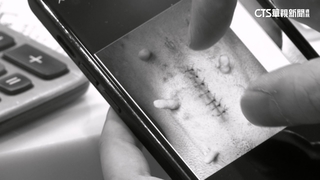 狒死後獸醫比對結紮傷口　確認六福村所有