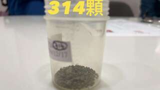 胃痛復發竟發現「314顆」膽結石！　尿尿這顏色藏警訊　醫提4點好發情況