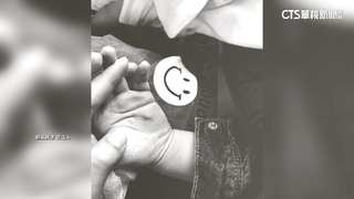 男童玩溜滑梯割傷手　廟方：暫停使用.加強維護