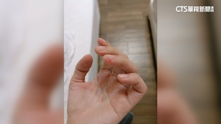 削死皮削到見血！　遊客控：店家未先告知就弄傷