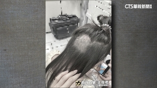 心疼！　餵藥案孩童剃髮「禿一塊」　家長憂二次傷害