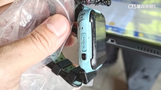 轟！　智慧型手表突自燃　10歲男童手臂燙傷恐植皮
