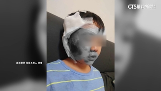 新北10歲童走斑馬線被機車撞倒　臉部嚴重擦傷