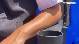 大批球迷皮膚痛癢　嘉市棒球場：疑座椅問題