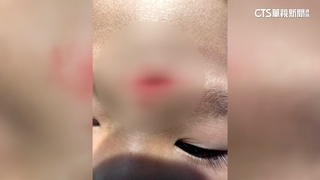 童室內遊樂場摔破頭　家長控百貨業者消極對待