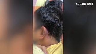 招牌擋騎樓！　婦用腳移開遭毆腦震盪　店家認打人道歉