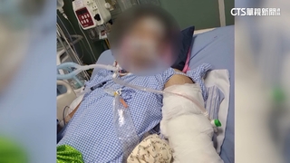 逃逸移工撞人肇逃判刑將遣返　被害求償無門