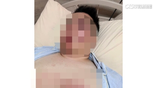 騎樓施工被迫走馬路　男控遭撞骨折.視力毀