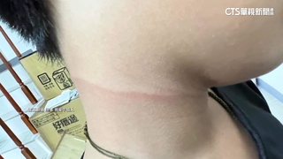 兩童「鐵線綁長椅」惡作劇　男童遭勒脖慘摔