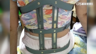 北市婦遭撞脊椎骨折　肇事駕駛：閃違停釀禍