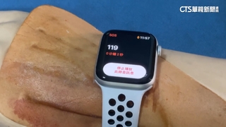 駕駛車禍受傷！　智慧型手錶偵測撞擊自動通報119