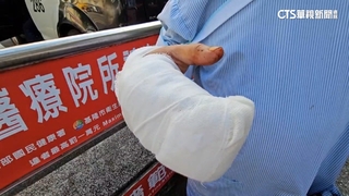 拆違建碎玻璃砸損鄰車　承包商遭車主砍斷手指