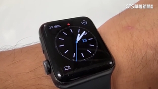 7旬婦騎車自摔昏迷！　智慧手表打119報案救人