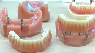 植牙1顆5~15萬價差大！　醫師年資.耗材都有影響