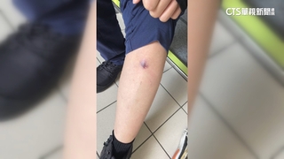 誇張！飼主明知狗會咬人　蓄意開門放狗咬警察