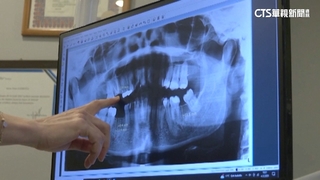 牙口差又鬧牙醫荒！　英國人赴海外做牙科治療