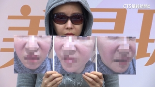 醫美「少女針」假貨盛行　紅腫發炎持續四年險毀容