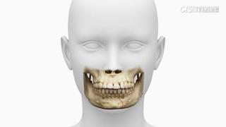 車禍「臉骨斷十截」！　醫療團隊「人骨拼圖」修復容貌