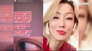 鄭秀文誤用「清潔劑」卸妝　貼文放「眼白充血照」示警