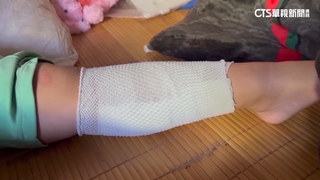 今天是大姊生日！　彰化3姊弟遭撞　2姊妹昏迷