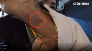 60萬人朝聖鹽水蜂炮　狂炸61傷「企鵝妹也掛彩」