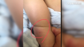 澎湖兒少館草地藏「繩索陷阱」　1歲童遭絆倒跌傷