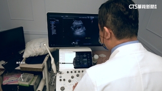 男稱妻產檢1次9800元　婦產名醫：幻想文？想看收據