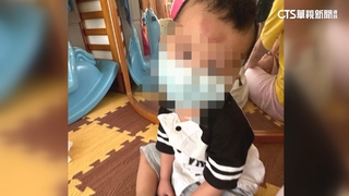 又有兒虐？　北市通報兩案「兒少保護」　一死一住院