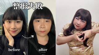 NanaQ疑拔智齒「臉腫一圈」　曬「整形失敗」照引網笑：董月花小姐？