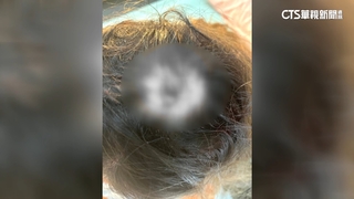 這週第3人！　女山友「玉山登山口」被落石砸頭