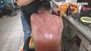 暖心！按摩師替救災弟兄刮痧　司機送貨助災民