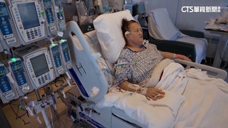美國第2人！　54歲女子移植「豬腎」撿回一命