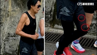 周潤發大腿驚冒2凸起物？眼尖網友憂腫瘤籲就診