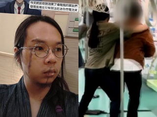 中捷英雄「長髮男」近況曝光！　臉上留兩道長傷痕　還開玩笑道：終於吃到泡芙