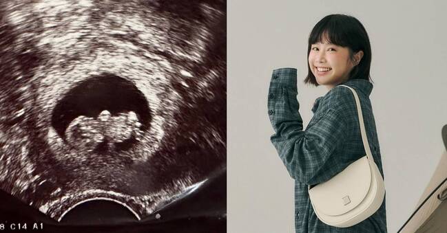 李佳穎41歲試管成功「懷孕5個月」！ 淚吐孕初期2次大出血 | 華視新聞
