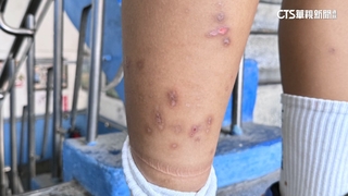 雨天停車場打球學生過敏　校方：風雨操場明年完工